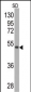 SOD2 Antibody